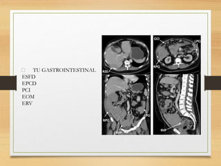 TU GASTROINTESTINAL
ESFD
EPCD
PCI
EOM
ERV
 