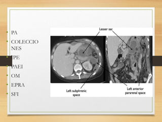 • PA
• COLECCIO
NES
• IPE
• PAEI
• OM
• EPRA
• SFI
 