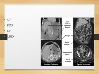 • NP
• PDS
• LV
• LHD
 