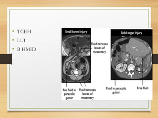 • TCEH
• LLT
• B HMID
 