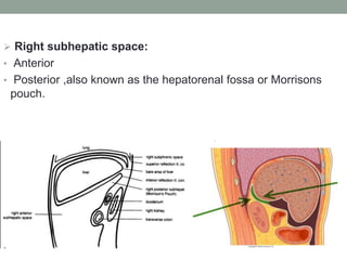  Right subhepatic space:
• Anterior
• Posterior ,also known as the hepatorenal fossa or Morrisons
pouch.
 