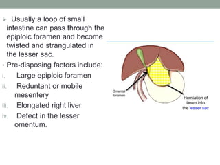  Usually a loop of small
intestine can pass through the
epiploic foramen and become
twisted and strangulated in
the lesser sac.
• Pre-disposing factors include:
i. Large epiploic foramen
ii. Reduntant or mobile
mesentery
iii. Elongated right liver
iv. Defect in the lesser
omentum.
 