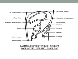 SAGITTAL SECTION THROUGH THE LEFT
LOBE OF THE LIVER AND LESSER SAC
 