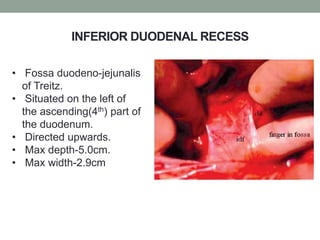 INFERIOR DUODENAL RECESS
• Fossa duodeno-jejunalis
of Treitz.
• Situated on the left of
the ascending(4th) part of
the duodenum.
• Directed upwards.
• Max depth-5.0cm.
• Max width-2.9cm
 