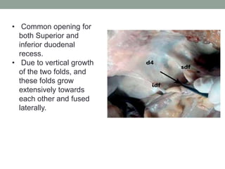 • Common opening for
both Superior and
inferior duodenal
recess.
• Due to vertical growth
of the two folds, and
these folds grow
extensively towards
each other and fused
laterally.
 