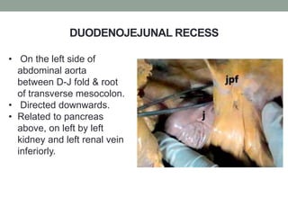 DUODENOJEJUNAL RECESS
• On the left side of
abdominal aorta
between D-J fold & root
of transverse mesocolon.
• Directed downwards.
• Related to pancreas
above, on left by left
kidney and left renal vein
inferiorly.
 