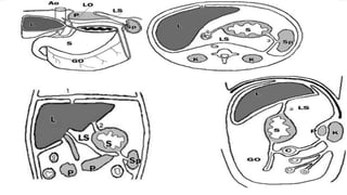 Peritoneum | PPTX