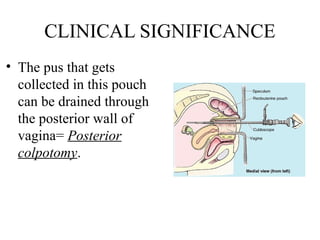 Anatomy of peritoneum with applied aspects. | PPTX