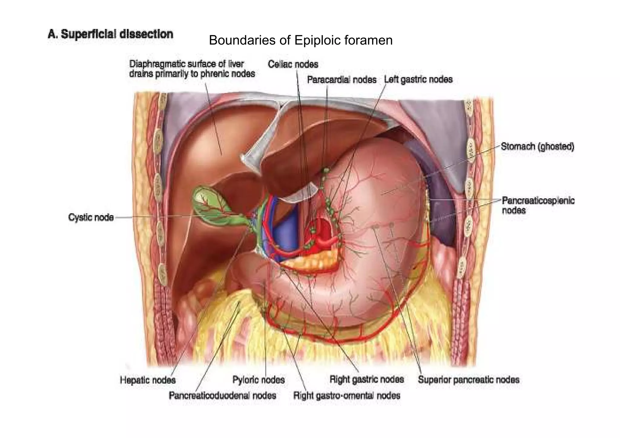 Boundaries of Epiploic foramen
 