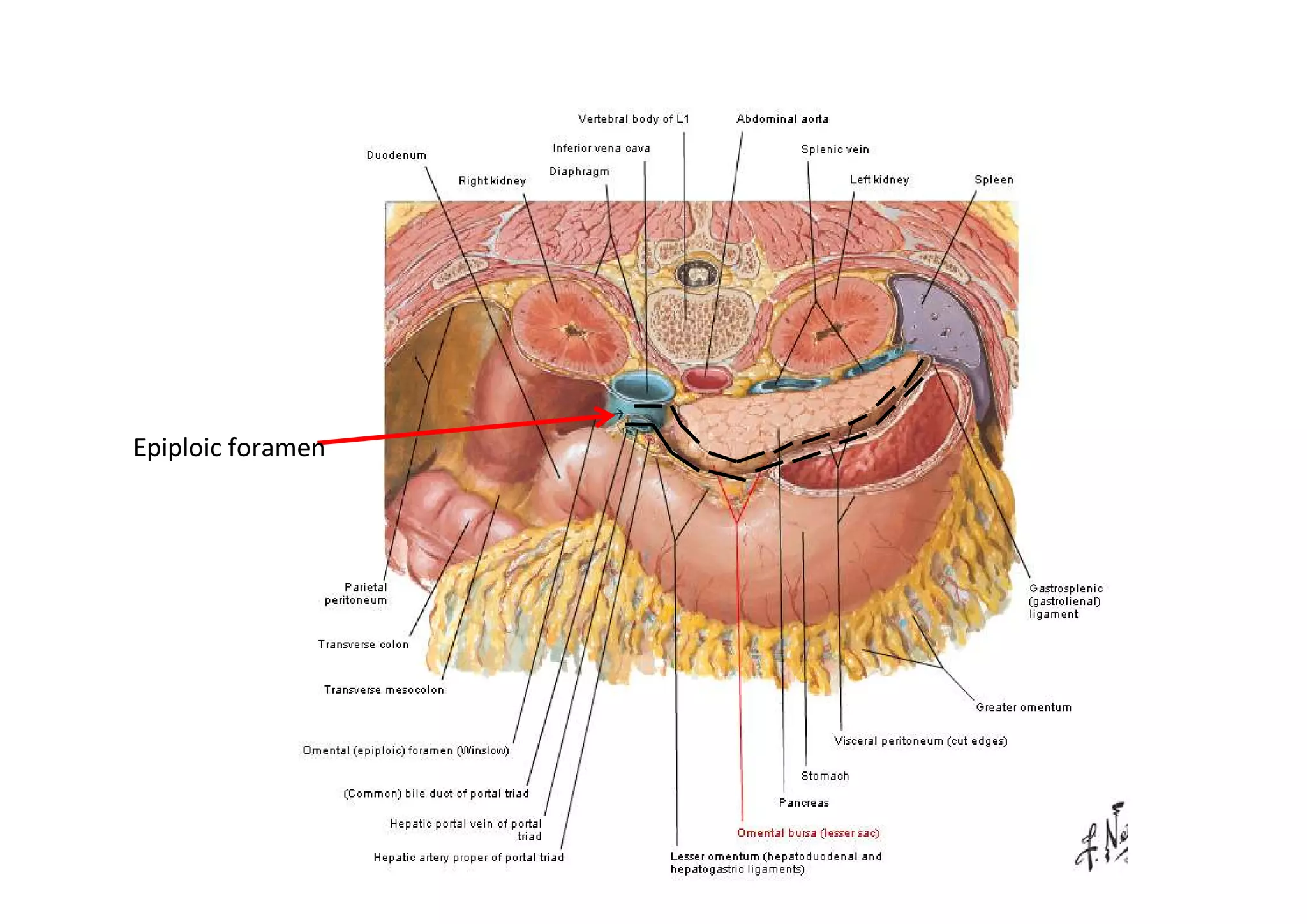 Epiploic foramen
 