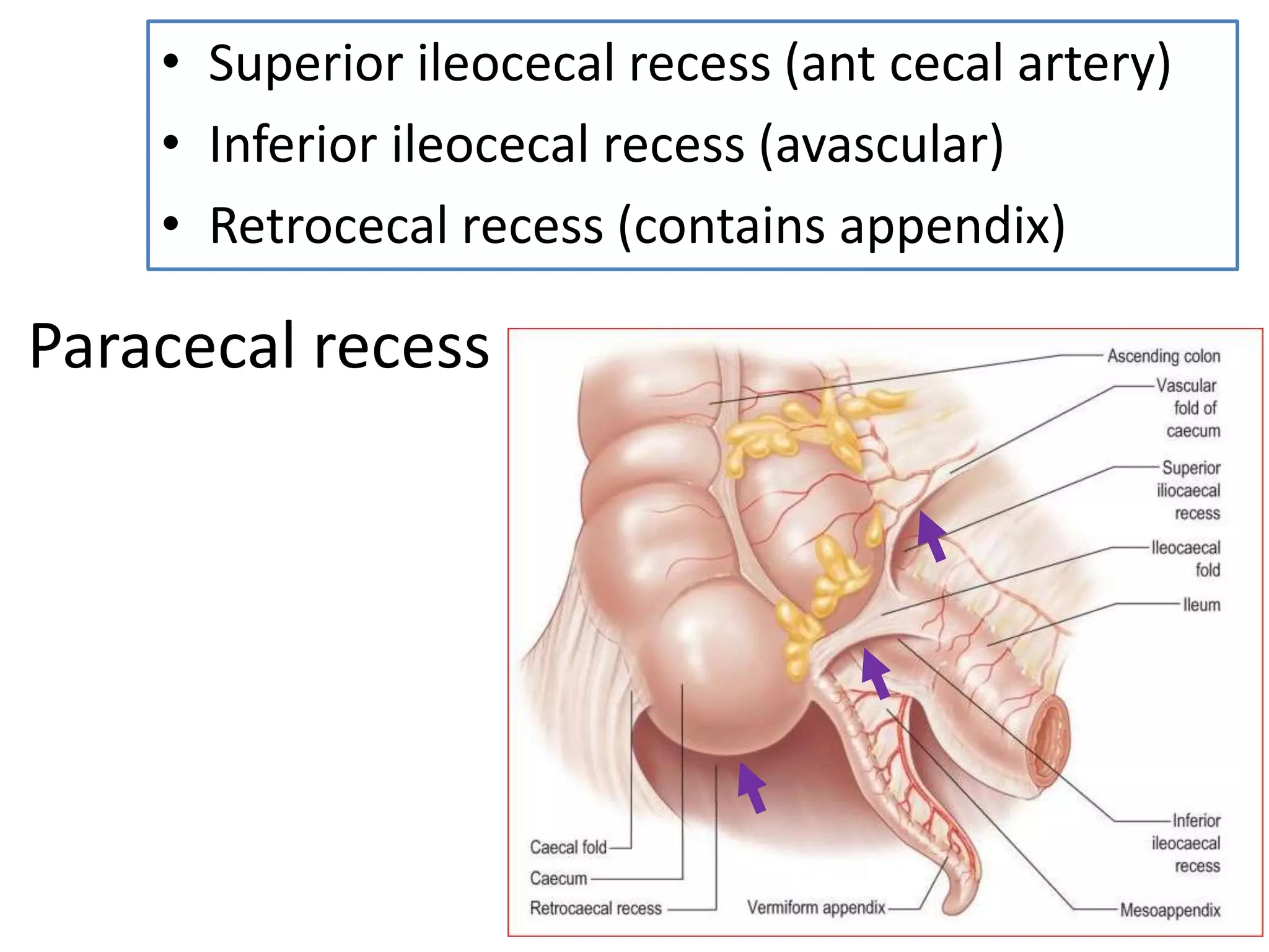 Paracecal recess
• Superior ileocecal recess (ant cecal artery)
• Inferior ileocecal recess (avascular)
• Retrocecal recess (contains appendix)
 