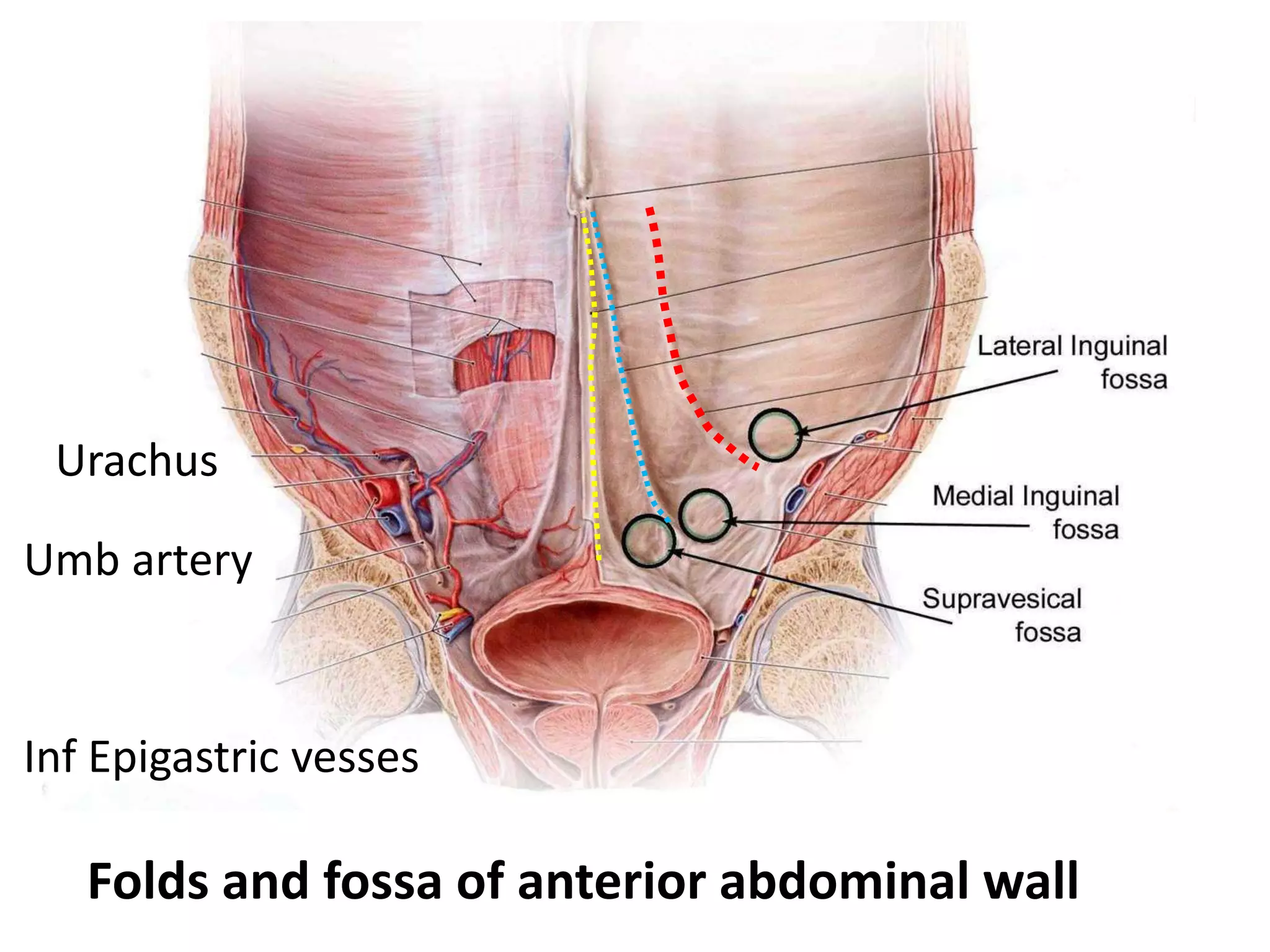Urachus
Umb artery
Inf Epigastric vesses
Folds and fossa of anterior abdominal wall
 