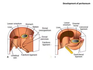 Peritoneum Defect PERITONEUM PPT FULL with applied anatomy.pptx