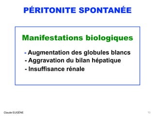 PÉRITONITE SPONTANÉE
Manifestations biologiques
- Augmentation des globules blancs
- Aggravation du bilan hépatique
- Insuffisance rénale
Claude EUGÈNE 10
 