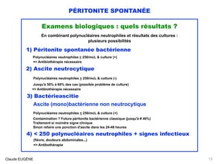 PÉRITONITE SPONTANÉE
Examens biologiques : quels résultats ?
En combinant polynucléaires neutrophiles et résultats des cultures :
plusieurs possibilités
1) Péritonite spontanée bactérienne
Polynucléaires neutrophiles > 250/mcL & culture (+) 
=> Antibiothérapie nécessaire
2) Ascite neutrocytique 
Polynucléaires neutrophiles > 250/mcL & culture (-) 
Jusqu'à 50% à 60% des cas (possible problème de culture)
=> Antibiothérapie nécessaire
3) Bactérieascitie 
Ascite (mono)bactérienne non neutrocytique 
Polynucléaires neutrophiles < 250/mcL & culture (+) 
Contamination ? Future péritonite bactérienne classique (jusqu'à # 40%) 
Traitement si moindre signe clinique 
Sinon refaire une ponction d'ascite dans les 24-48 heures
4) < 250 polynucléaires neutrophiles + signes infectieux 
(fièvre, douleurs abdominales...) 
=> Antibothérapie 
Claude EUGÈNE 13
 