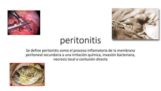 peritonitis
Se define peritonitis como el proceso inflamatorio de la membrana
peritoneal secundaria a una irritación química, invasión bacteriana,
necrosis local o contusión directa
 