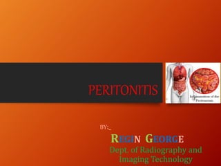 PERITONITIS
BY:_
REGIN GEORGE
Dept. of Radiography and
Imaging Technology
 