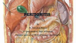 PERITONITIS
By
Dr. Abhishek Kumar
2nd year resident, Dept. of Surgery
National Institute of Medical Sciences and Hospital
 