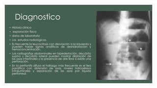 Diagnostico
• Historia clínica
• exploración física
• datos de laboratorio
• Los estudios radiológicos.
• Es frecuente la leucocitosis con desviación a la izquierda y
pueden haber signos analíticos de deshidratación y
hemoconcentración.
• Las radiografías abdominales en bipedestación, decúbito
supino y decúbito lateral pueden mostrar dilatación de
las asas intestinales y la presencia de aire libre si existe una
perforación.
• En la peritonitis difusa el hallazgo más frecuente es el íleo
paralítico con distensión de asas, niveles hidroaéreos
intraluminales y separación de las asas por líquido
peritoneal.
 