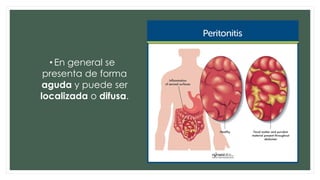 • En general se
presenta de forma
aguda y puede ser
localizada o difusa.
 