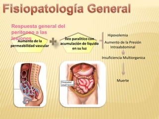 Insuficiencia Multiorganica
Aumento de la
permeabilidad vascular
Íleo paralitico con
acumulación de líquido
en su luz
Hipovolemia
Aumento de la Presión
Intraabdominal
Muerte
Respuesta general del
peritoneo a las
lesiones
 