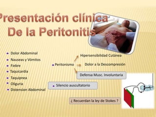 Peritonismo Dolor a la Descompresión
Hipersensibilidad Cutánea
Defensa Musc. Involuntaria
Dolor Abdominal
Nauseas y Vómitos
Fiebre
Taquicardia
Taquipnea
Silencio auscultatorio
¿ Recuerdan la ley de Stokes ?
Oliguria
Distension Abdominal
 