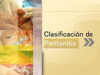 Clasificación de
Peritonitis
 