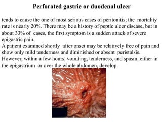 Perforated gastric or duodenal ulcer
tends to cause the one of most serious cases of peritonitis; the mortality
rate is nearly 20%. There may be a history of peptic ulcer disease, but in
about 33% of cases, the first symptom is a sudden attack of severe
epigastric pain.
A patient examined shortly after onset may be relatively free of pain and
show only mild tenderness and diminished or absent peristalsis.
However, within a few hours, vomiting, tenderness, and spasm, either in
the epigastrium or over the whole abdomen, develop.
 