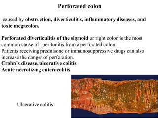 Perforated colon
caused by obstruction, diverticulitis, inflammatory diseases, and
toxic megacolon.
Perforated diverticulitis of the sigmoid or right colon is the most
common cause of peritonitis from a perforated colon.
Patients receiving prednisone or immunosuppressive drugs can also
increase the danger of perforation.
Crohn’s disease, ulcerative colitis
Acute necrotizing enterocolitis
Ulcerative colitis
 