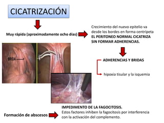 CICATRIZACIÓN
Muy rápida (aproximadamente ocho días)
Crecimiento del nuevo epitelio va
desde los bordes en forma centrípeta
EL PERITONEO NORMAL CICATRIZA
SIN FORMAR ADHERENCIAS.
ADHERENCIAS Y BRIDAS
hipoxia tisular y la isquemia
Formación de abscesos
IMPEDIMENTO DE LA FAGOCITOSIS.
Estos factores inhiben la fagocitosis por interferencia
con la activación del complemento.
 