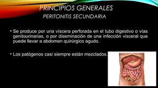 PRINCIPIOS GENERALES
• Se produce por una víscera perforada en el tubo digestivo o vías
genitourinarias, o por diseminación de una infección visceral que
puede llevar a abdomen quirúrgico agudo.
• Los patógenos casi siempre están mezclados.
PERITONITIS SECUNDARIA
 