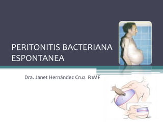 PERITONITIS BACTERIANA
ESPONTANEA
Dra. Janet Hernández Cruz R1MF
 