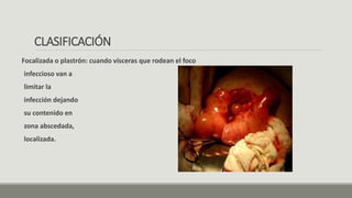 CLASIFICACIÓN
Focalizada o plastrón: cuando vísceras que rodean el foco
infeccioso van a
limitar la
infección dejando
su contenido en
zona abscedada,
localizada.
 