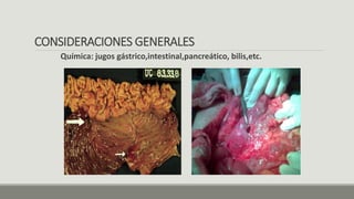 CONSIDERACIONES GENERALES
Química: jugos gástrico,intestinal,pancreático, bilis,etc.
 