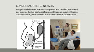 CONSIDERACIONES GENERALES
Fúngica:casi siempre por invasión previa a la cavidad peritoneal
por cirugía, diálisis peritoneales repetitivas que pueden llevar a
contaminación, paracentesis. Son habitualmente las terciarias.
 