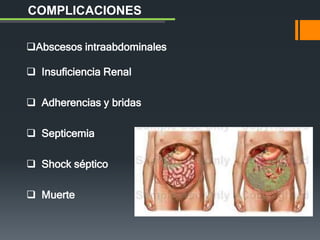 Abscesos intraabdominales
 Insuficiencia Renal
 Adherencias y bridas
 Septicemia
 Shock séptico
 Muerte
COMPLICACIONES
 