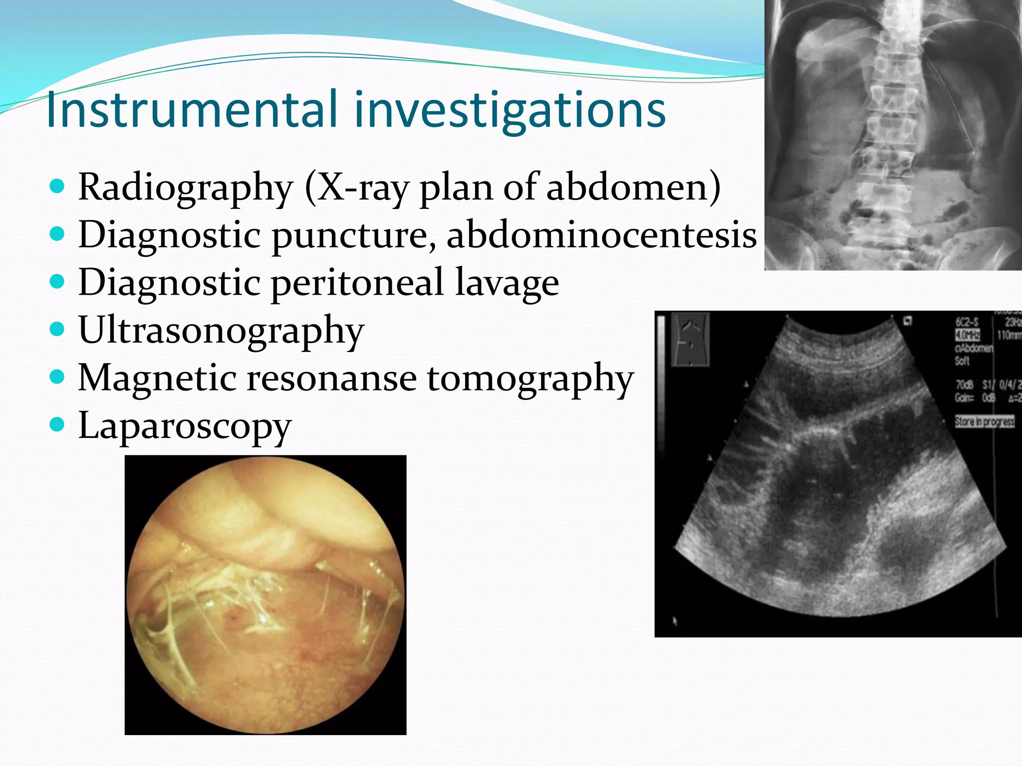 Instrumental investigations
 Radiography (X-ray plan of abdomen)
 Diagnostic puncture, abdominocentesis
 Diagnostic peritoneal lavage
 Ultrasonography
 Magnetic resonanse tomography
 Laparoscopy
 