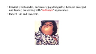 • Cervical lymph nodes, particularly jugulodigastric, become enlarged
and tender, presenting with “bull-neck” appearance.
• Patient is ill and toxaemic.
 