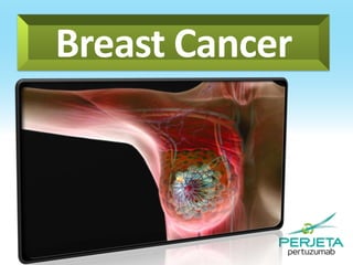 Breast Cancer

 