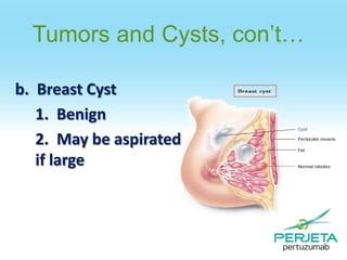 Tumors and Cysts, con’t…
b. Breast Cyst
1. Benign
2. May be aspirated
if large

 