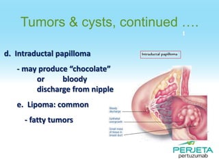 Tumors & cysts, continued ….
d. Intraductal papilloma
- may produce “chocolate”
or
bloody
discharge from nipple
e. Lipoma: common
- fatty tumors

 