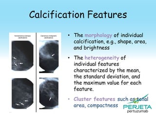 Calcification Features
• The morphology of individual
calcification, e.g., shape, area,
and brightness
• The heterogeneity of
individual features
characterized by the mean,
the standard deviation, and
the maximum value for each
feature.
• Cluster features such as total
area, compactness
97

 
