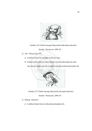 44 

 




              Gambar 2.26 Teknik massage Menyeterika dahi pada muka bayi

                           Sumber : Prasetyono, 2009, 68

    2) Alis : Menyeterika Alis

       a) Letakkan kedua ibu jari anda kedua alis mata

       b) Gunakan kedua ibu jari untuk memijat secara lembut pada alis mata

           dan diatas kelopak mata dari tengah kesamping seolah menyeterika alis




            Gambar 2.27 Teknik massage Menyterika alis pada muka bayi

                           Sumber : Prasetyono, 2009, 69

    3) Hidung : Senyum I

       a) Letakkan kedua ibu jari anda pada pertengahan alis




 
 