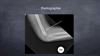 Radiographie
 