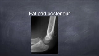 Fat pad postérieur
 