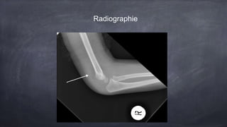 Radiographie
 