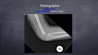 Radiographie
pedxray.com
urgencehsj.ca - trauma coude
 