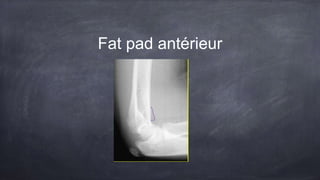 Fat pad antérieur
 