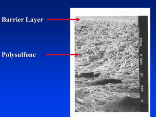 Barrier Layer
Polysulfone
 