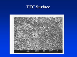 TFC Surface
 